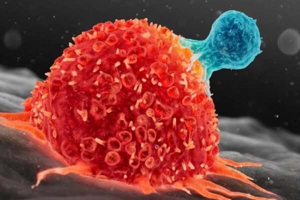 ‘TRACeR-I’ to target the cancer cell